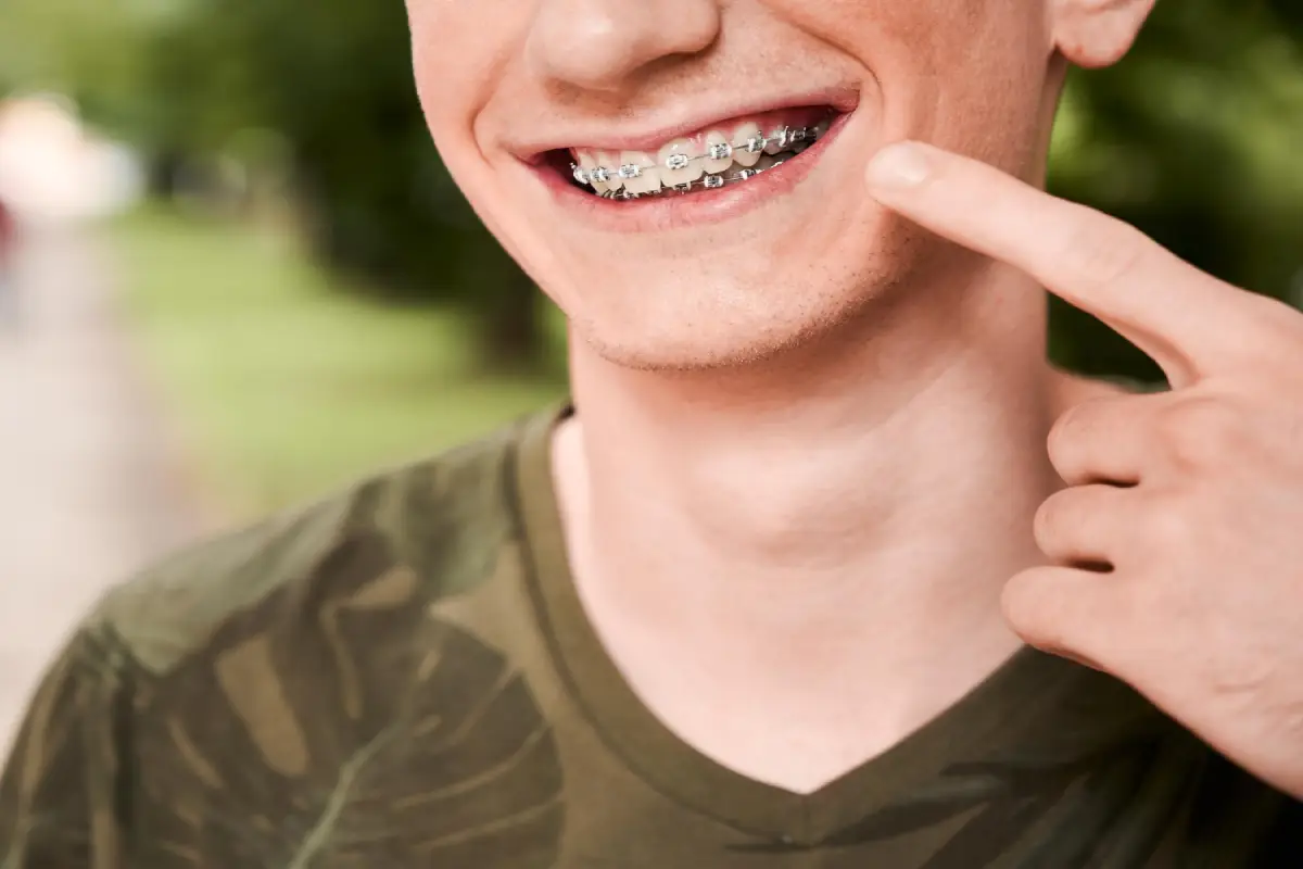 Smiling young man pointing to his braces